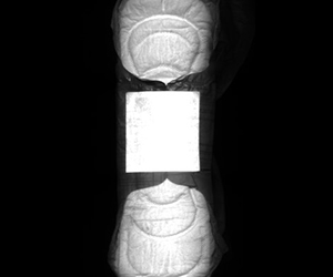 위생 냅킨 검사