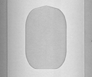  필름 드레싱 이미지(전면) 